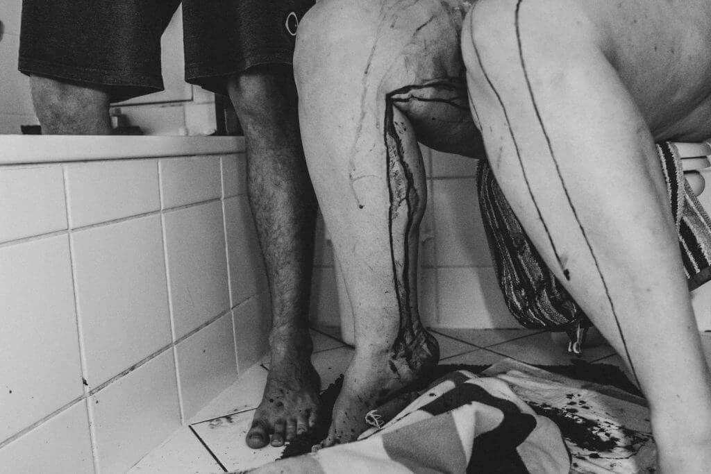 Beine mit getrocknetem Blut im Badezimmer mit bunten Handtüchern